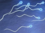 Спермограмма – показатель репродуктивных возможностей мужчины